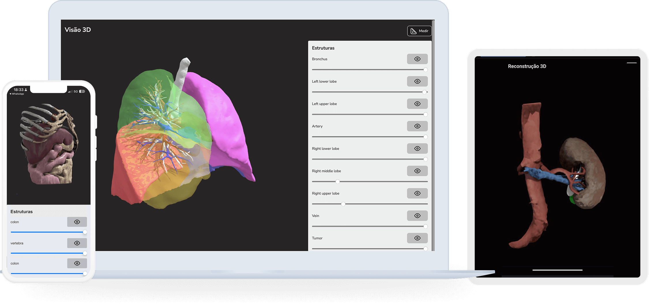 Mock-ups of the 3-D surgical viewer on different devices